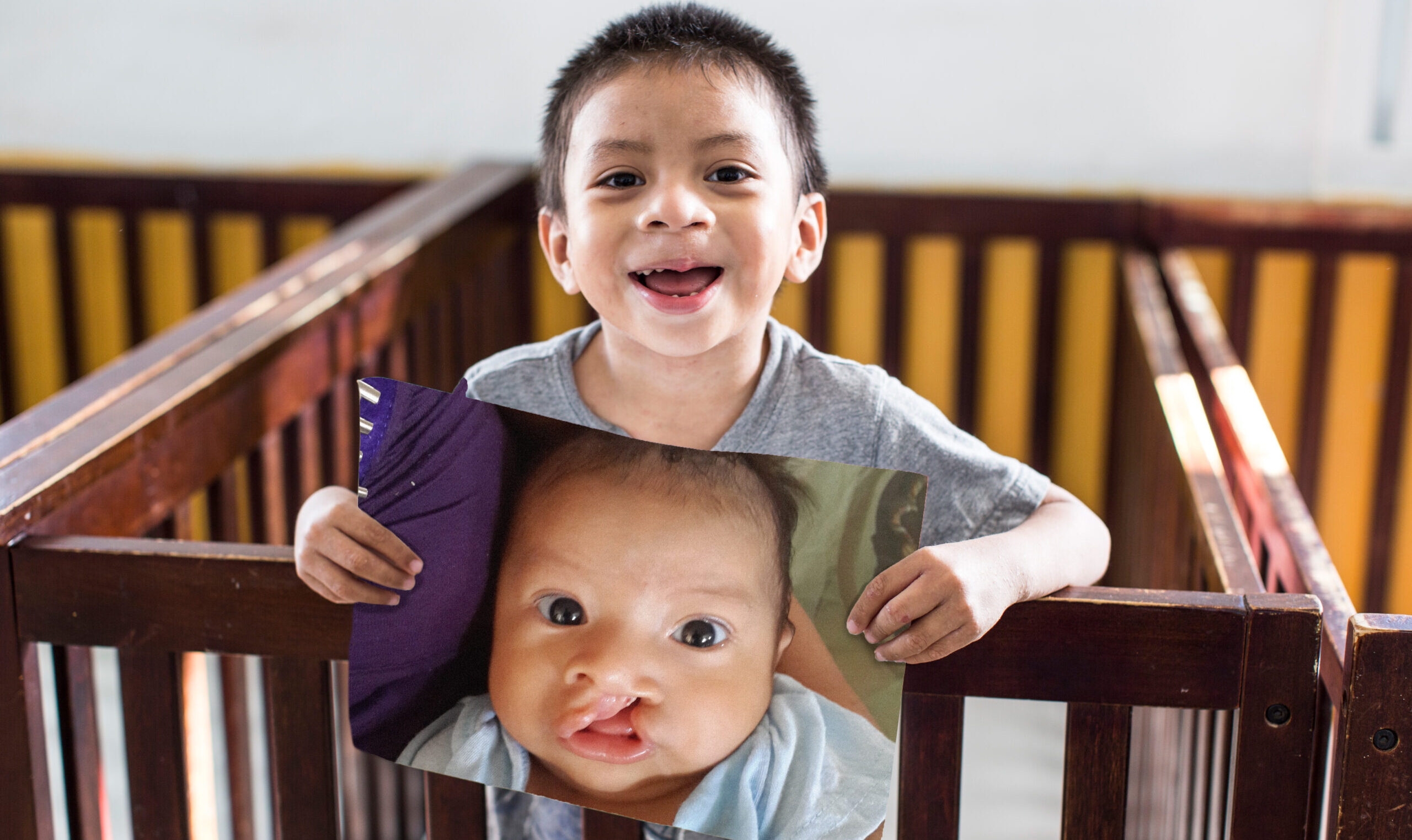 little boy smiling while she holds photo of herself before cleft surgery